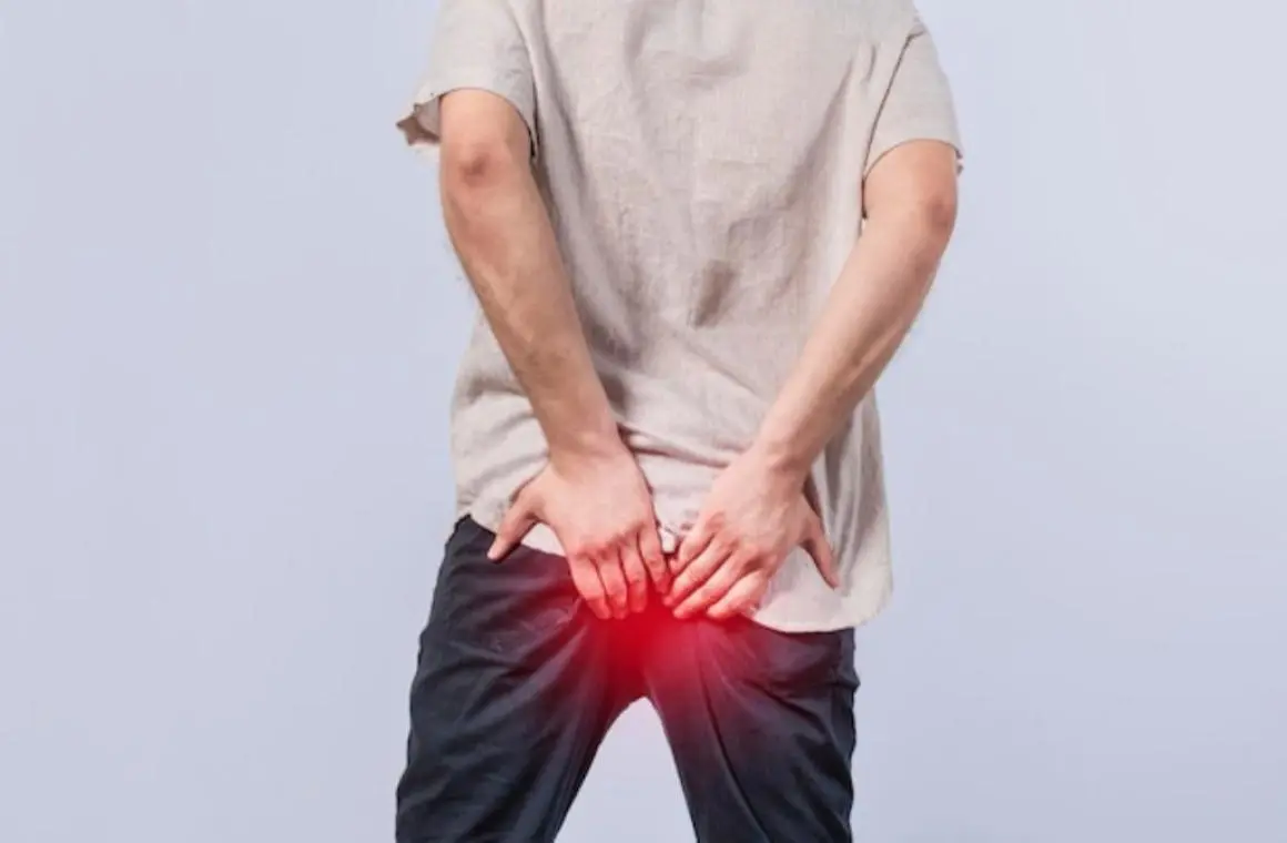 Laser Hemoroid, Solusi Minim Nyeri untuk Tangani Wasir